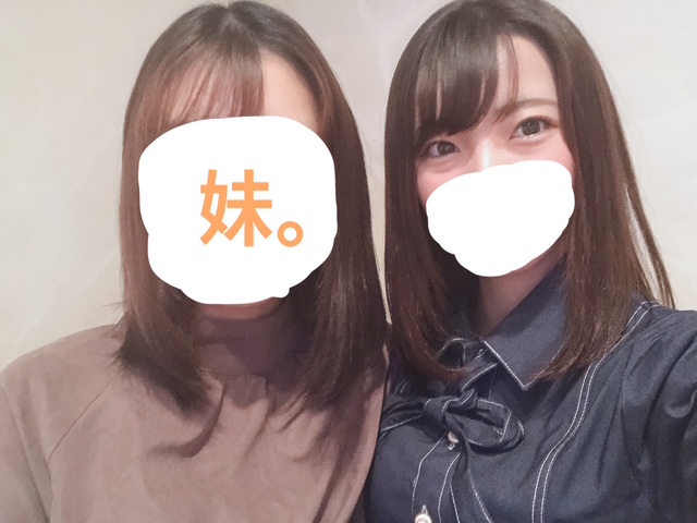 目の下の膨らみ取りを受ける前のビフォー写真。目の下に二重線のくまがある状態。